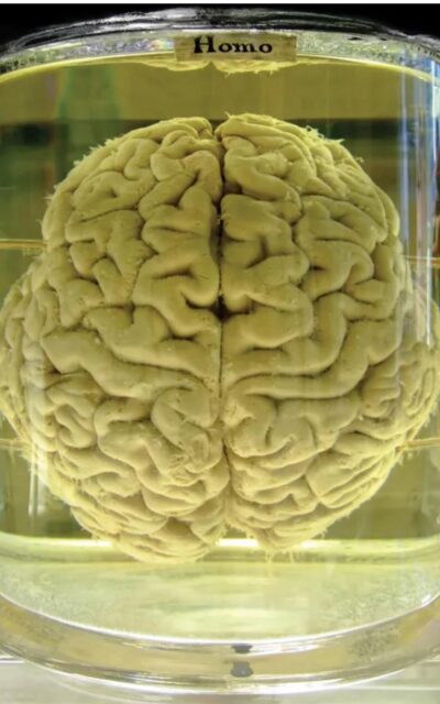 riavvio Marco Bassani cervello